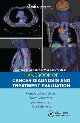 European Society for Medical Oncology Handbook of Cancer Diagnosis and Treatment Evaluation