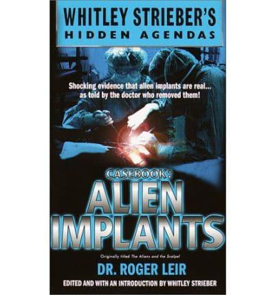 Alien Implants