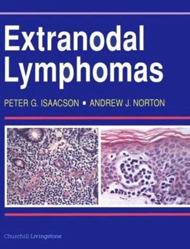 Extranodal Lymphomas