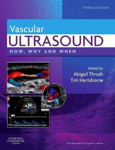 Vascular Ultrasound
