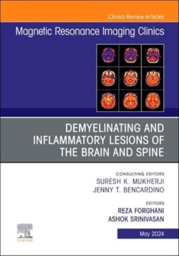 Demyelinating and Inflammatory Lesions of the Brain and Spine
