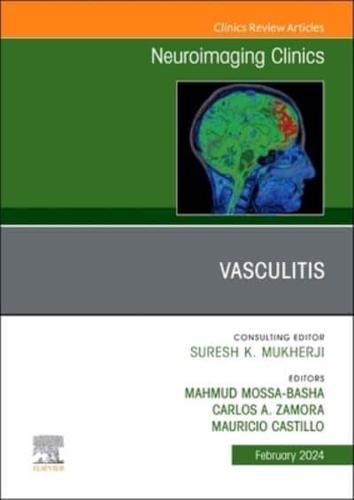 Vasculitis