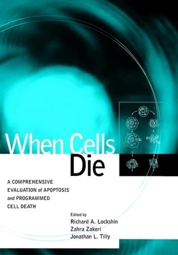 When Cells Die