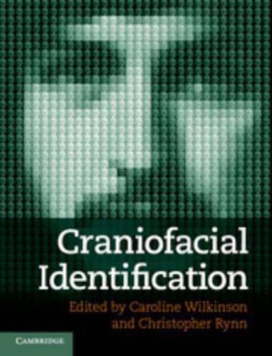 Craniofacial Identification
