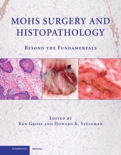 Mohs Surgery and Histopathology