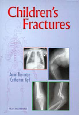 Children's Fractures