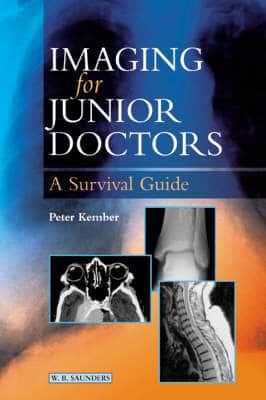 Imaging for Junior Doctors