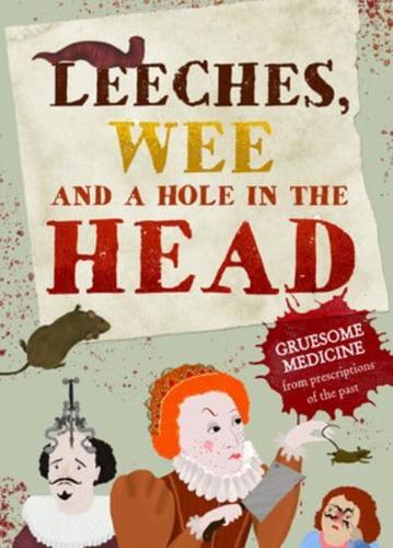 Leeches, Pee, and a Hole in the Head