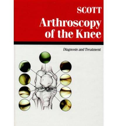 Arthroscopy of the Knee
