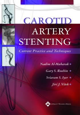 Carotid Artery Stenting