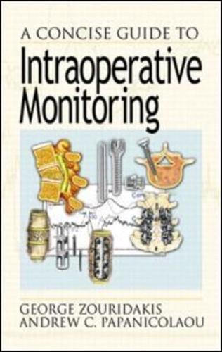 A Concise Guide to Intraoperative Monitoring