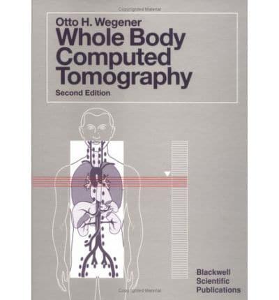 Whole Body Computed Tomography