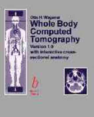 Whole Body Computed Tomography CD-ROM