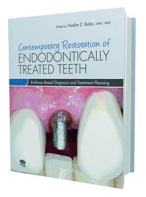 Contemporary Restoration of Endodontically Treated Teeth