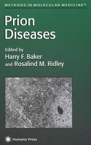 Prion Diseases