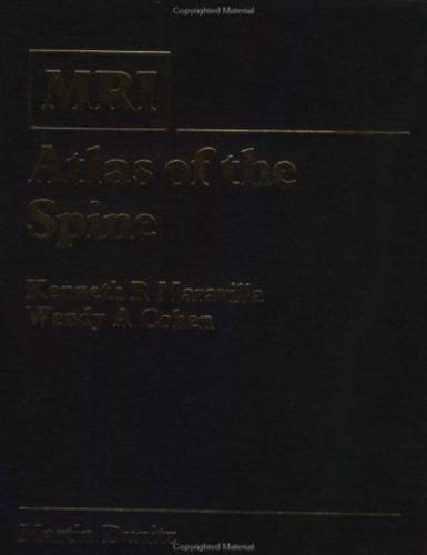 MRI Atlas of the Spine