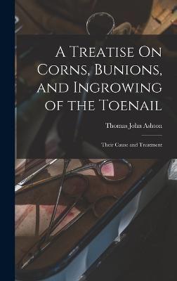 A Treatise On Corns, Bunions, and Ingrowing of the Toenail
