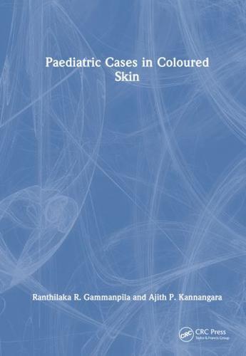 Paediatric Cases in Coloured Skin