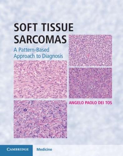 Soft Tissue Sarcomas