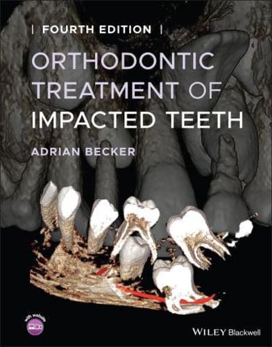 The Orthodontic Treatment of Impacted Teeth