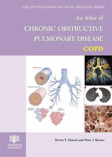 An Atlas of Chronic Obstructive Pulmonary Disease