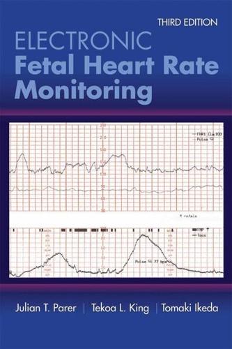 Electronic Fetal Heart Rate Monitoring