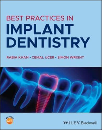Best Practices in Implant Dentistry