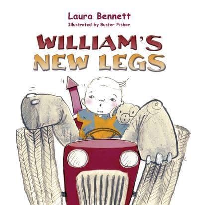 William's New Legs