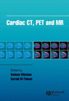 Cardiac CT, PET and MRI