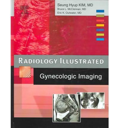 Radiology Illustrated. Gynecologic Imaging
