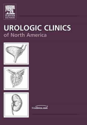 Advanced Cancer of the Prostate, An Issue of Urologic Clinics