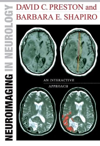 Neuroimaging in Neurology