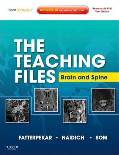 The Teaching Files. Brain and Spine Imaging