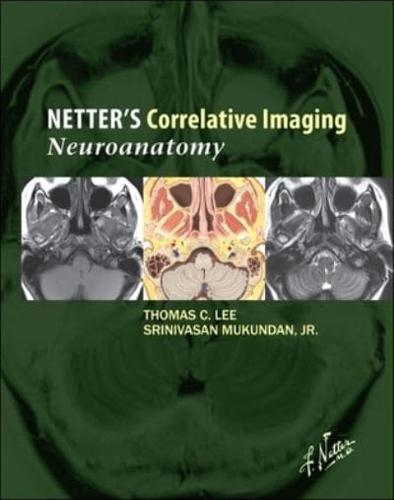 Netter's Correlative Imaging. Neuroanatomy
