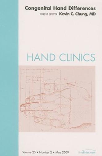 Congenital Hand Differences