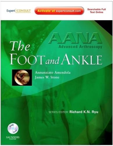 AANA Advanced Arthroscopy. The Foot and Ankle
