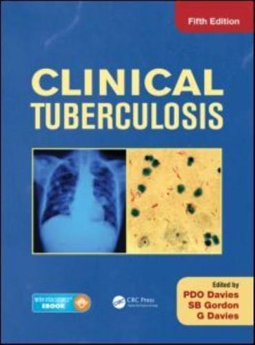 Clinical Tuberculosis