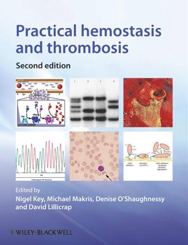 Practical Hemostasis and Thrombosis