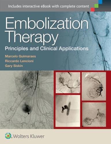 Embolization Therapy