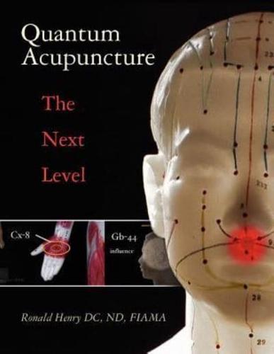 Quantum Acupuncture