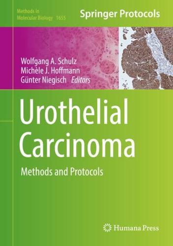 Urothelial Carcinoma : Methods and Protocols