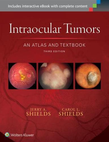 Intraocular Tumors