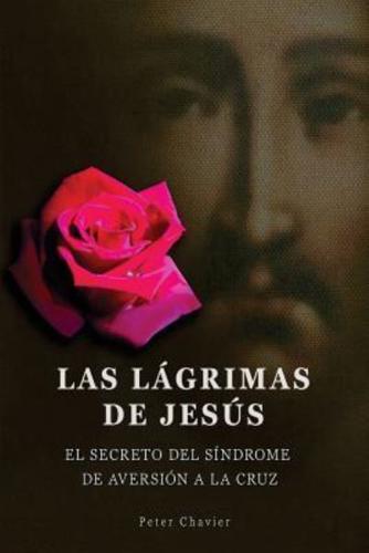 Las Lagrimas De Jesus -El Secreto Del Sindrome De La Inmolacion De La Cruz