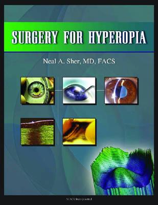 Surgery for Hyperopia