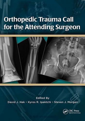 Orthopedic Trauma Call for the Attending Surgeon