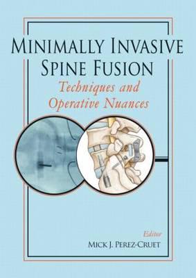 Minimally Invasive Spine Fusion