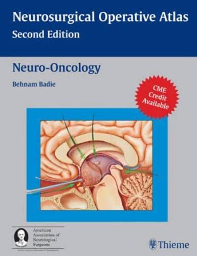 Neurosurgical Operative Atlas. Neuro-Oncology