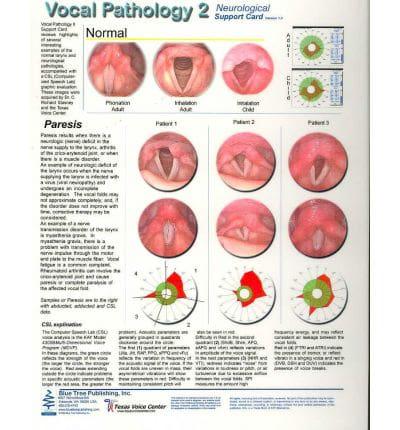 Vocal Pathology