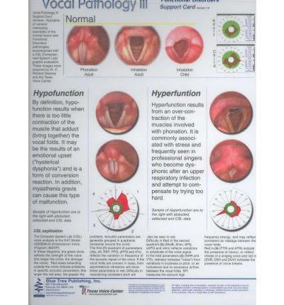 Vocal Pathology