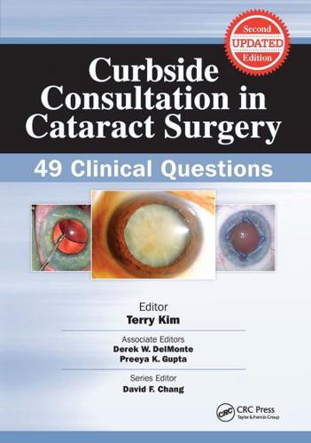 Curbside Consultation in Cataract Surgery